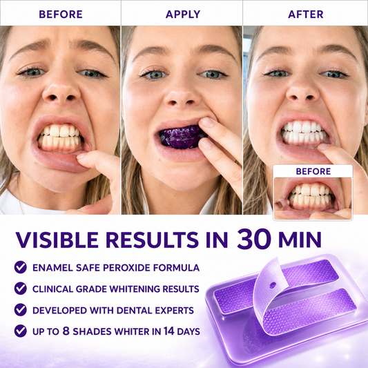 PurpleSmile™ At-Home Teeth Whitening Strips