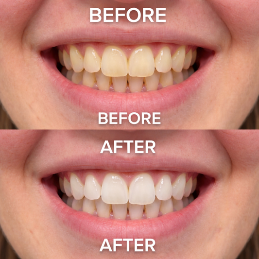 RELIFLY PurpleSmile Whitening Strips