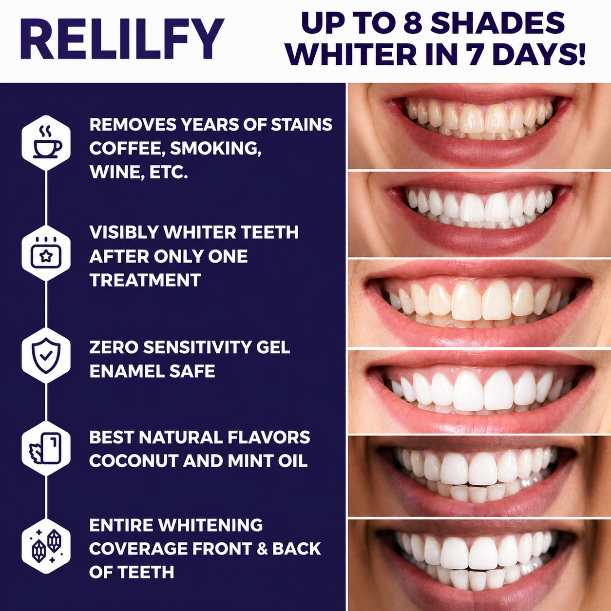 PurpleSmile™ At-Home Teeth Whitening Strips